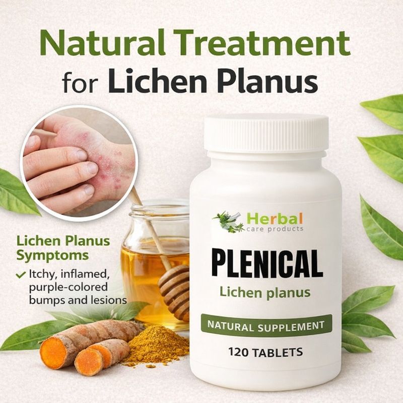 How to Get Rid of Lichen Planus Naturally - Image 1